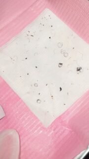 Vajacial: More Than Just a Treatment 
A vajacial is not just a facial; it’s a unique experience that helps you feel comfortable in your own skin. Embrace self-love and reconnect with your body! 💖 
This treatment targets ingrown hairs and helps rejuvenate the delicate areas, leaving you feeling refreshed and confident. Don’t neglect yourself—make self-care a priority! Treat yourself to this magical experience and love your skin all over again!